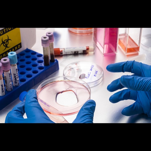 [0494-0506-015] E. Coli Recombinant Angola marburgvirus Glycoprotein minus the Transmembrane Region ''MARV Angola rGPΔTM''   100ug